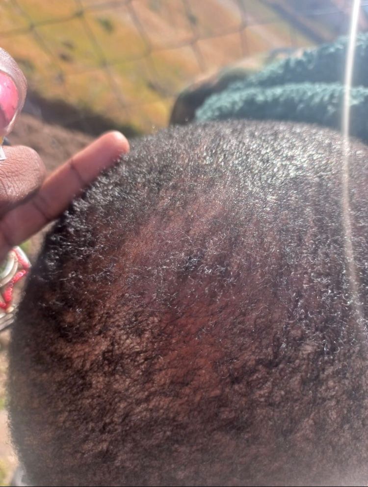 Botlē Hair Growth combo by SEFATE SA BOPHELO_1