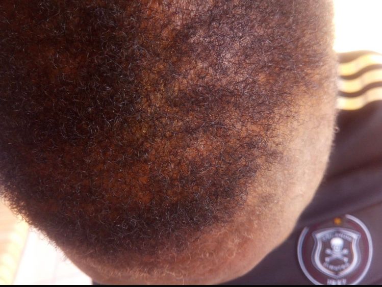 Botlē Hair Growth combo by SEFATE SA BOPHELO_3