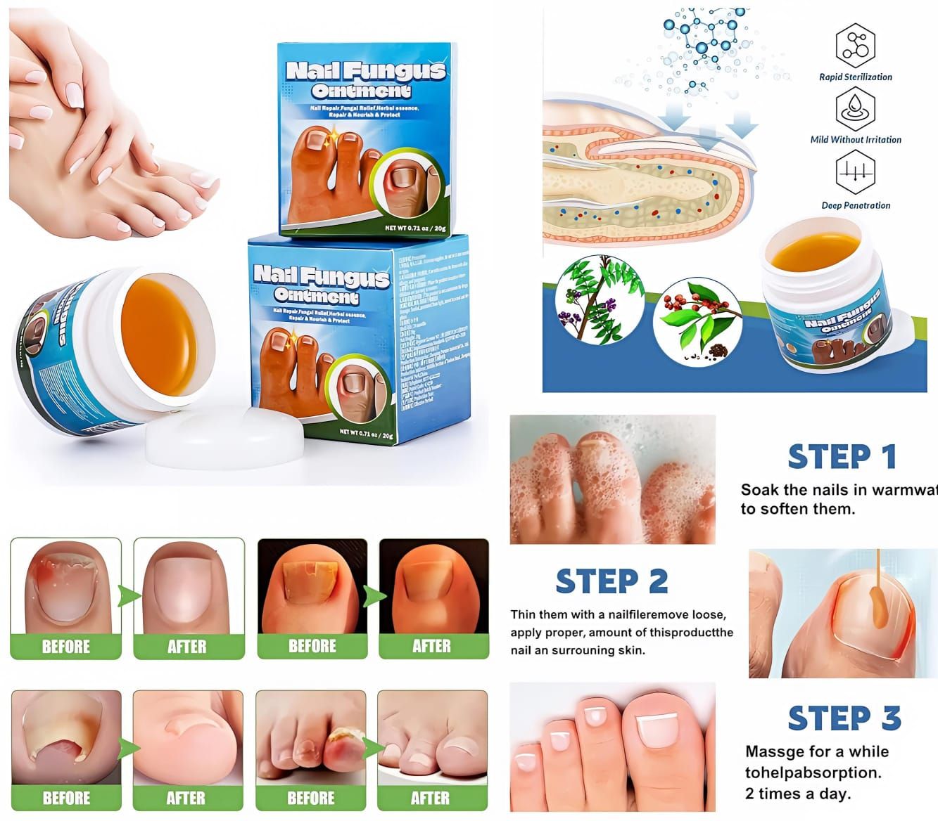 Nail Fungus Ointment_0