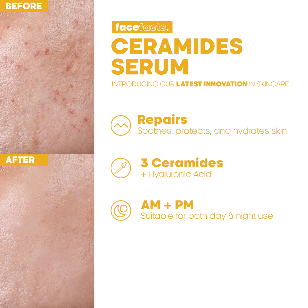 Face Facts Barrier Repair Ceramide Facial Serum_2