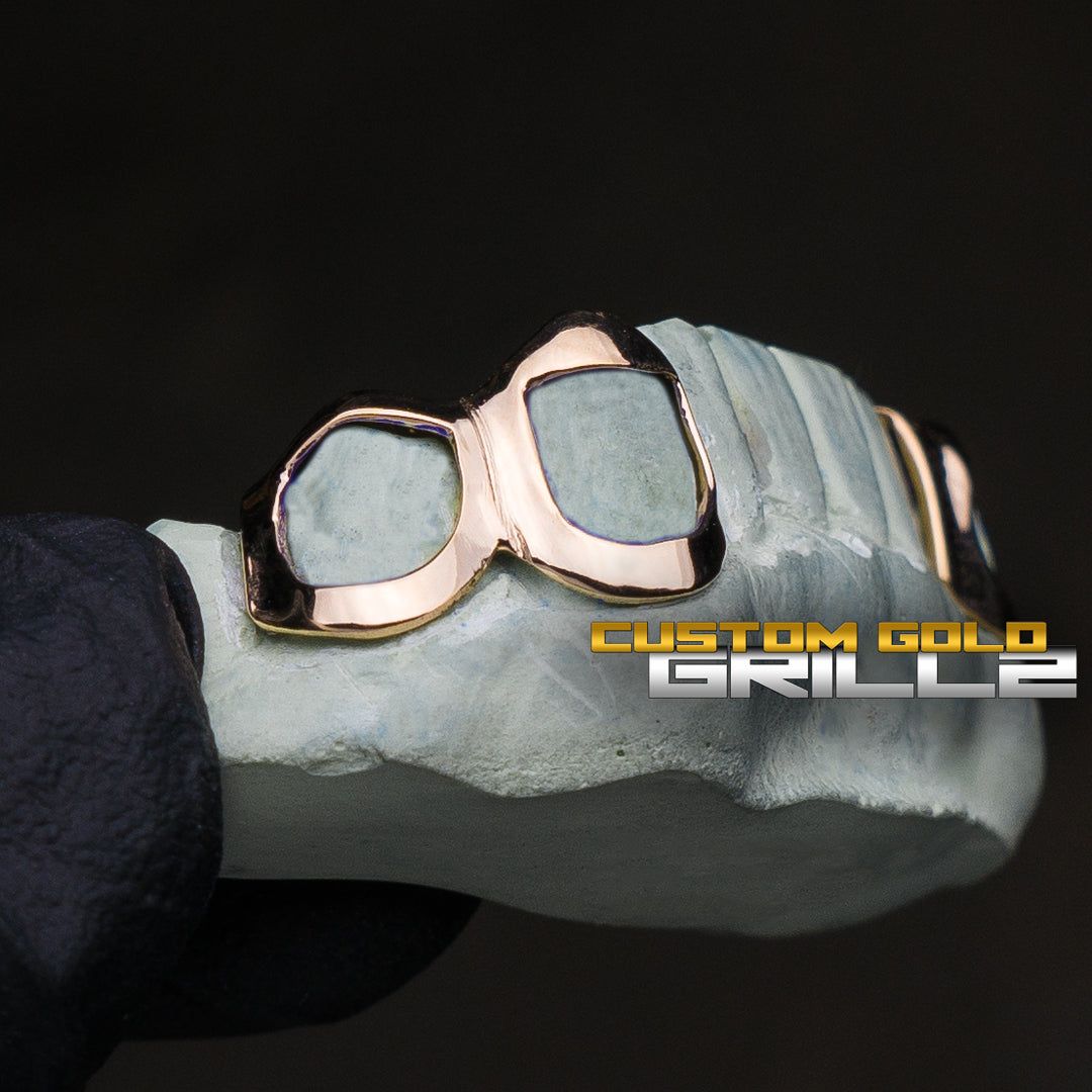 SOLID GOLD DOUBLE CAP TOOTH GRILLZ_1