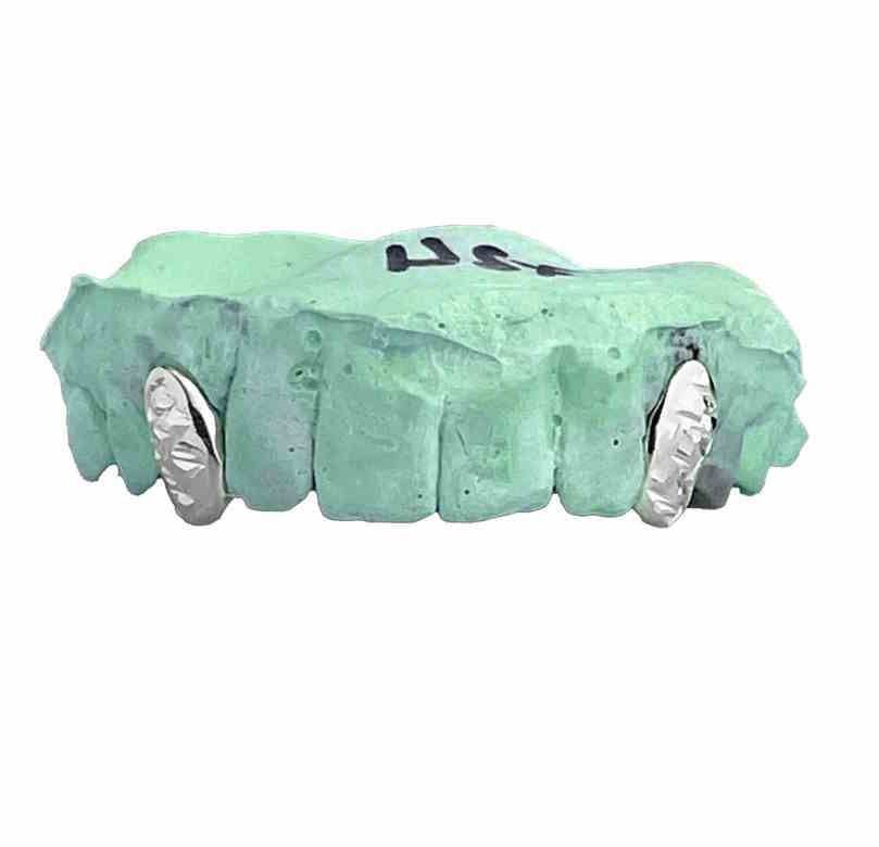 925 Silver Diamond Cut Caps Grillz [Custom][X2]_1