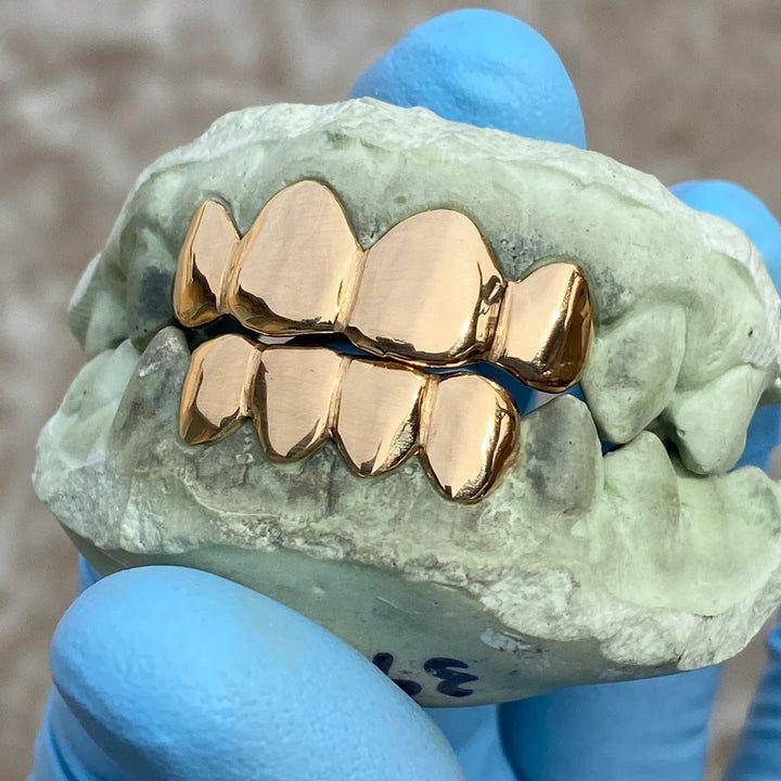 Real Solid 22K Gold Custom Grillz Teeth Grills_1