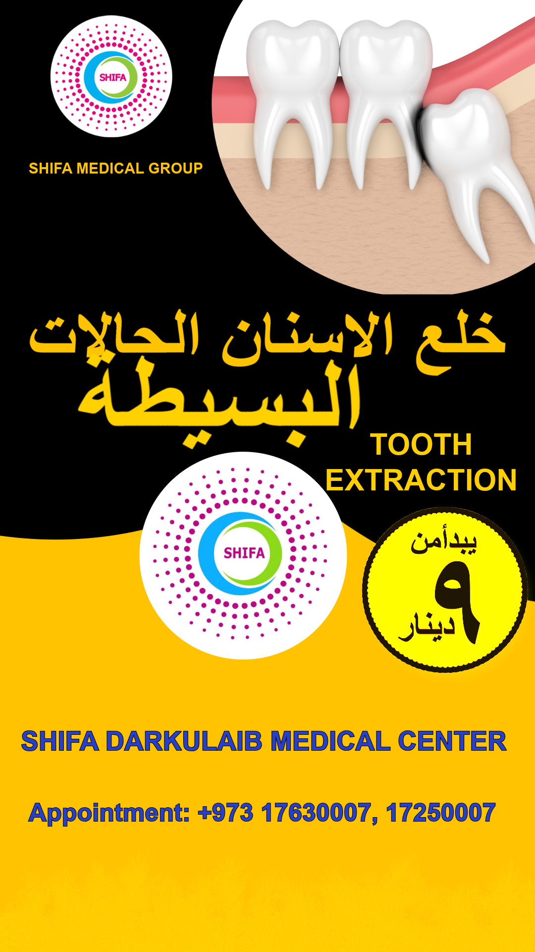 Simple Tooth Extraction_0