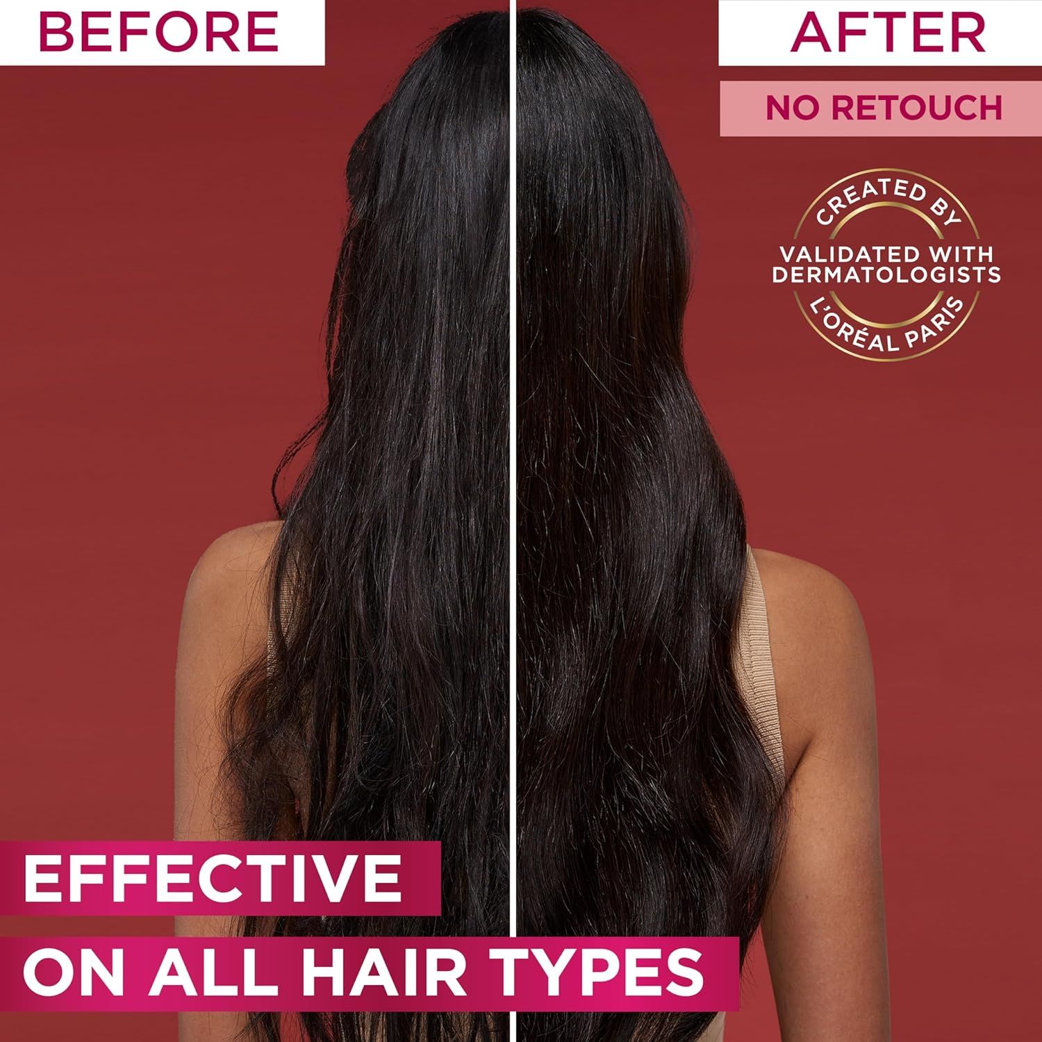 L’Oréal Paris Elvive Fall Resist Conditioner for Weak Hair and Hair Fall 360ML_3