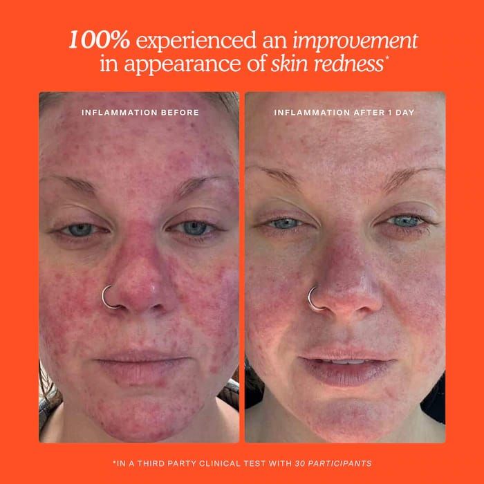 Tower 28 Beauty - SOS Daily Hypochlorous Acid Spray for Breakouts & Redness_4