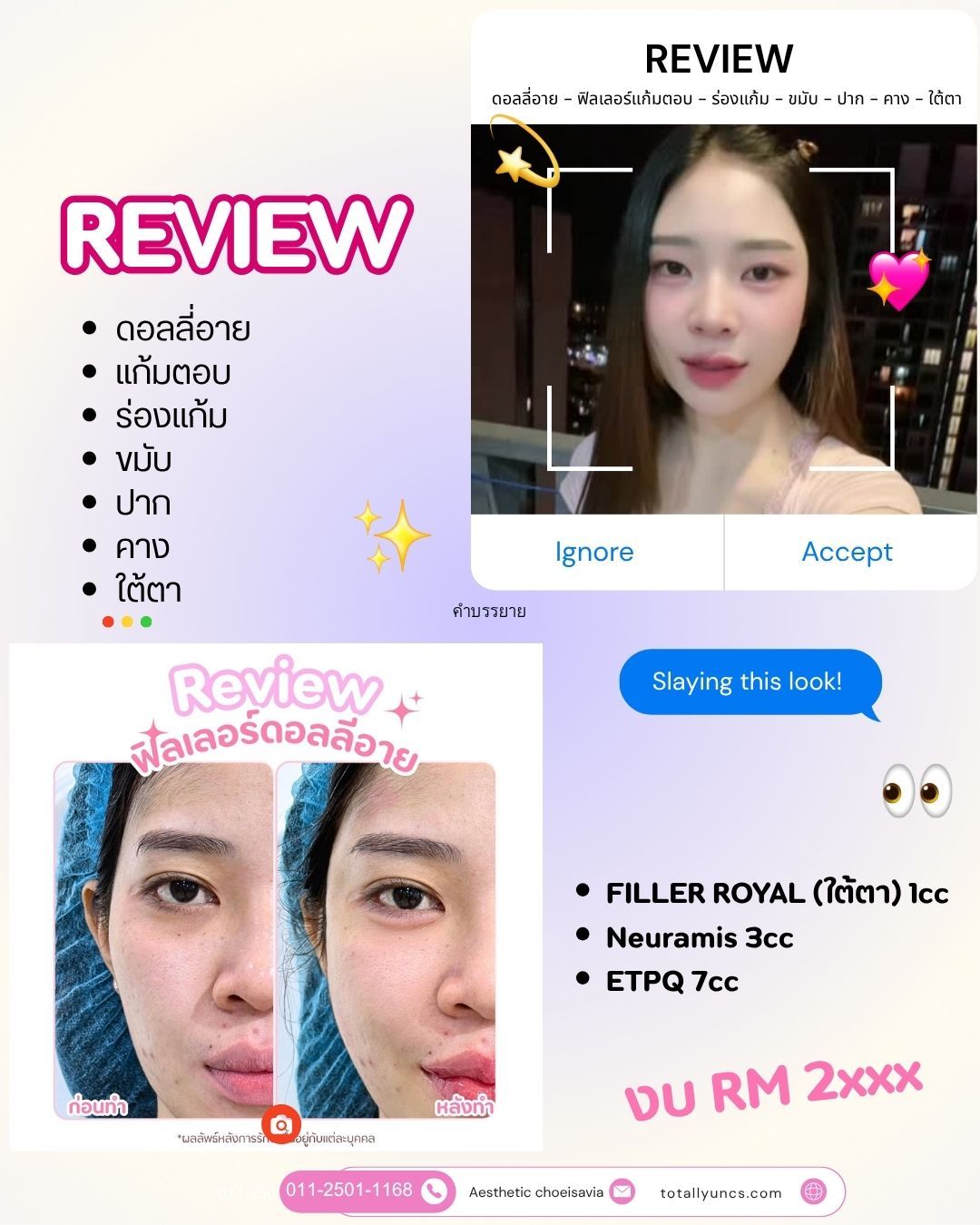 Review 🩷💉👸_0