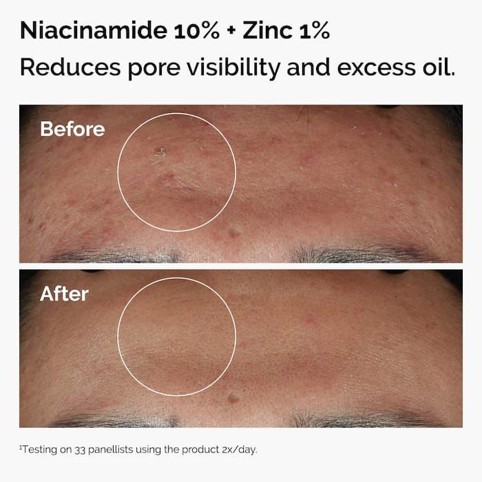 The Ordinary - The Skin Support Set with Niacinamide + Hyaluronic Acid_4