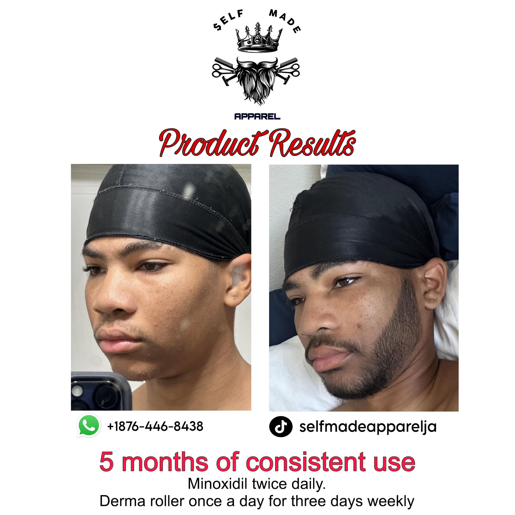 Minoxidil Liquid Solution _2