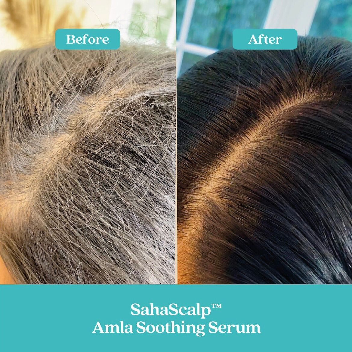 Fable & Mane Amla Soothing Serum _1