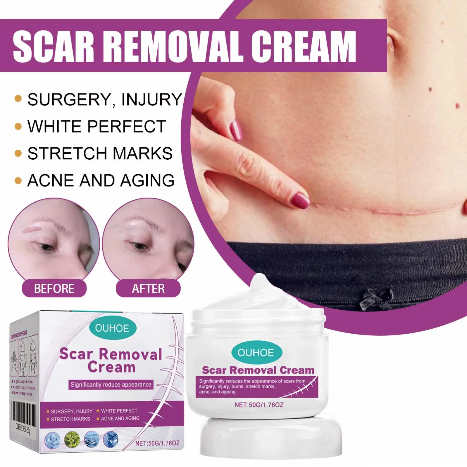 SCAR REMOVAL CREAM_1