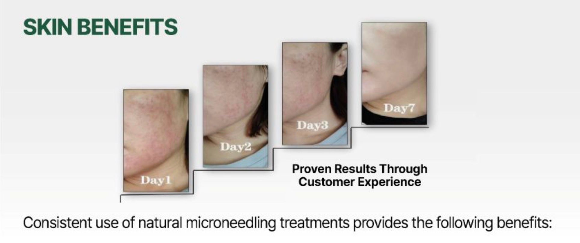 LIQUID NEEDLE PDRN AMPOULE_1