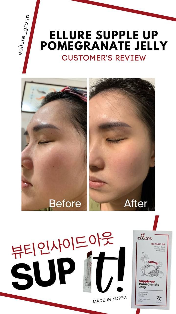 🇰🇷𝐌𝐀𝐃𝐄 𝐈𝐍 𝐊𝐎𝐑𝐄𝐀!🇰🇷 𝐄𝐋𝐋𝐔𝐑𝐄 𝟭𝟬-𝗜𝗡-𝟭 𝗥𝗘𝗗 𝗚𝗜𝗡𝗦𝗘𝗡𝗚 𝗦𝗞𝗜𝗡 𝗕𝗢𝗢𝗦𝗧𝗘𝗥 𝗝𝗘𝗟𝗟𝗬 | 𝐒𝐔𝐏-𝐈𝐓 𝐅𝐑𝐎𝐌 𝐊𝐎𝐑𝐄𝐀! SKIN SUPPLEMENT_29