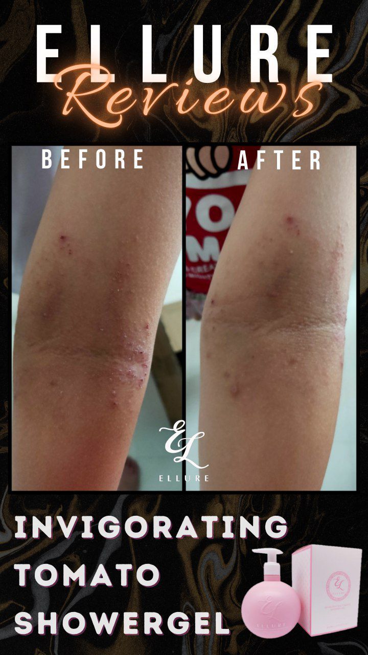 🍅𝐈𝐍𝐒𝐓𝐎𝐂𝐊🍅 𝐄𝐋𝐋𝐔𝐑𝐄 𝐓𝐎𝐌𝐀𝐓𝐎 𝐈𝐍𝐕𝐈𝐆𝐎𝐑𝐀𝐓𝐈𝐍𝐆 𝐒𝐇𝐎𝐖𝐄𝐑 𝐆𝐄𝐋| Skin Problems | Eczema | Back Acne | Sweat Prone Skin | Dry Skin_7