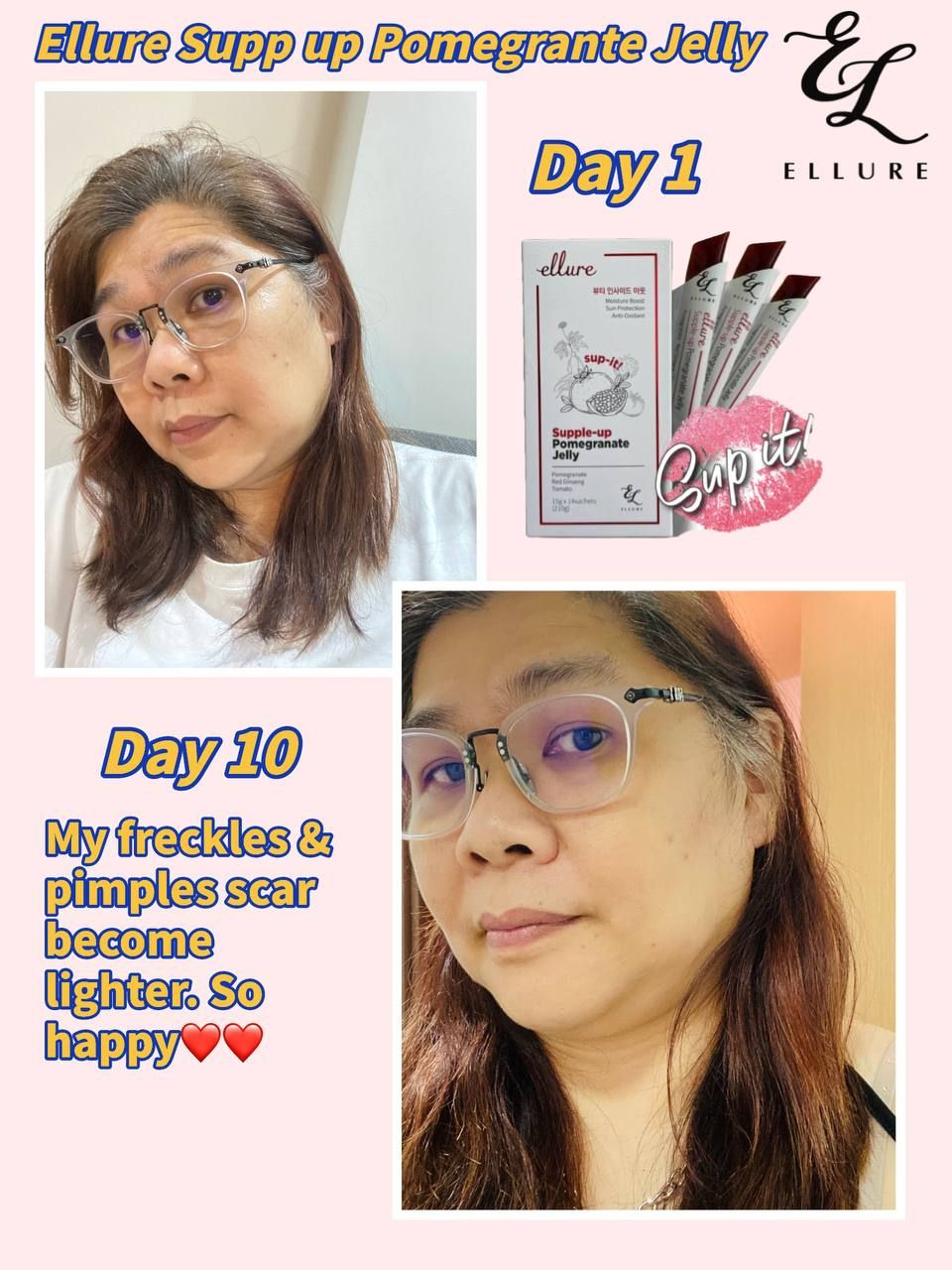 🇰🇷𝐌𝐀𝐃𝐄 𝐈𝐍 𝐊𝐎𝐑𝐄𝐀!🇰🇷 𝐄𝐋𝐋𝐔𝐑𝐄 𝟭𝟬-𝗜𝗡-𝟭 𝗥𝗘𝗗 𝗚𝗜𝗡𝗦𝗘𝗡𝗚 𝗦𝗞𝗜𝗡 𝗕𝗢𝗢𝗦𝗧𝗘𝗥 𝗝𝗘𝗟𝗟𝗬 | 𝐒𝐔𝐏-𝐈𝐓 𝐅𝐑𝐎𝐌 𝐊𝐎𝐑𝐄𝐀! SKIN SUPPLEMENT_24