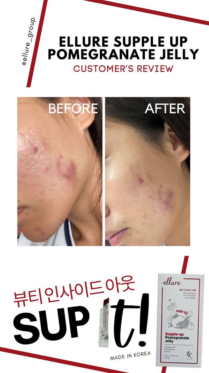 🇰🇷𝐌𝐀𝐃𝐄 𝐈𝐍 𝐊𝐎𝐑𝐄𝐀!🇰🇷 𝐄𝐋𝐋𝐔𝐑𝐄 𝟭𝟬-𝗜𝗡-𝟭 𝗥𝗘𝗗 𝗚𝗜𝗡𝗦𝗘𝗡𝗚 𝗦𝗞𝗜𝗡 𝗕𝗢𝗢𝗦𝗧𝗘𝗥 𝗝𝗘𝗟𝗟𝗬 | 𝐒𝐔𝐏-𝐈𝐓 𝐅𝐑𝐎𝐌 𝐊𝐎𝐑𝐄𝐀! SKIN SUPPLEMENT_28