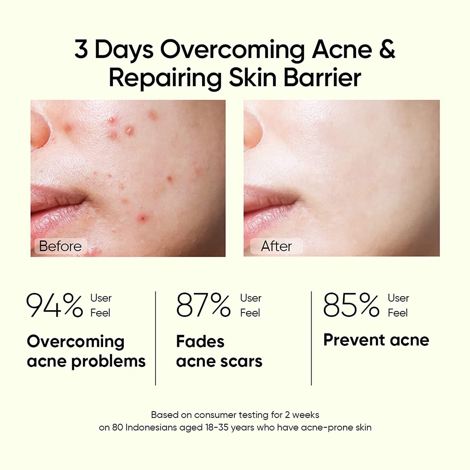 Skintific 2% Salicylic Acid Anti Acne Serum_4