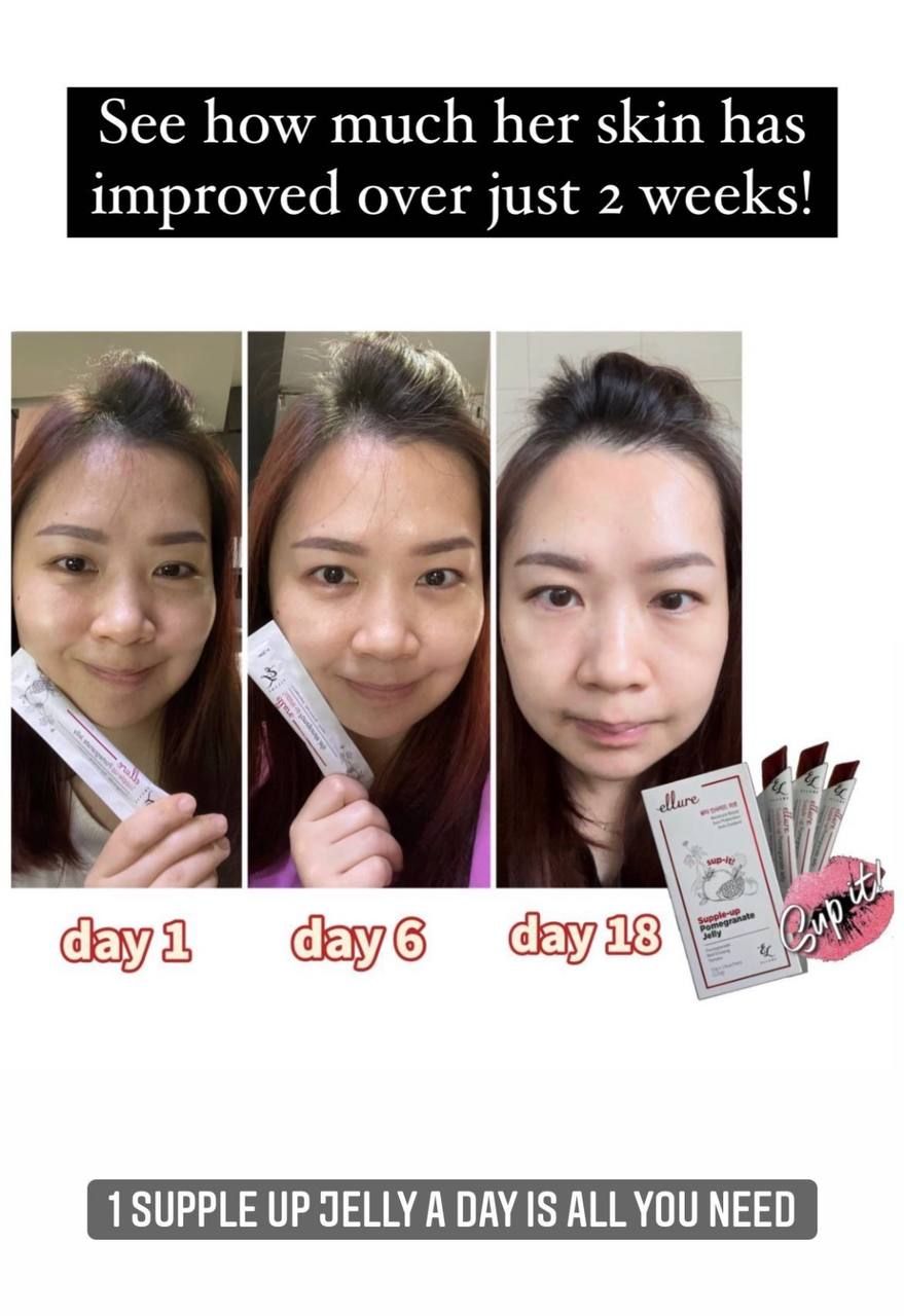🇰🇷𝐌𝐀𝐃𝐄 𝐈𝐍 𝐊𝐎𝐑𝐄𝐀!🇰🇷 𝐄𝐋𝐋𝐔𝐑𝐄 𝟭𝟬-𝗜𝗡-𝟭 𝗥𝗘𝗗 𝗚𝗜𝗡𝗦𝗘𝗡𝗚 𝗦𝗞𝗜𝗡 𝗕𝗢𝗢𝗦𝗧𝗘𝗥 𝗝𝗘𝗟𝗟𝗬 | 𝐒𝐔𝐏-𝐈𝐓 𝐅𝐑𝐎𝐌 𝐊𝐎𝐑𝐄𝐀! SKIN SUPPLEMENT_19