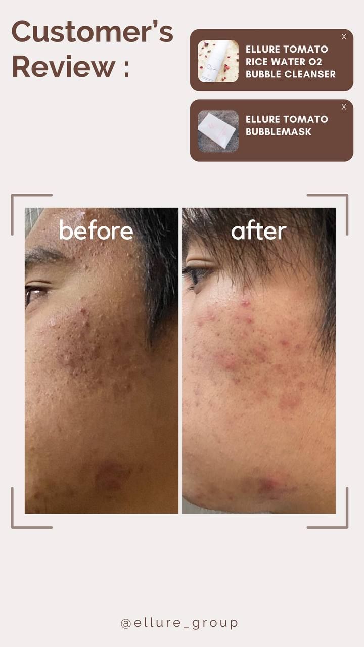 🔥𝐇𝐈𝐆𝐇𝐋𝐘 𝐑𝐀𝐕𝐄𝐃!!🔥 🍅𝐄𝐋𝐋𝐔𝐑𝐄 𝐓𝐎𝐌𝐀𝐓𝐎 𝐃𝐄𝐄𝐏 𝐂𝐋𝐄𝐀𝐍𝐒𝐈𝐍𝐆 𝐆𝐑𝐀𝐏𝐇𝐄𝐍𝐄 𝐁𝐔𝐁𝐁𝐋𝐄 𝐌𝐀𝐒𝐊🍅 - EXFOLIATING MASK_12