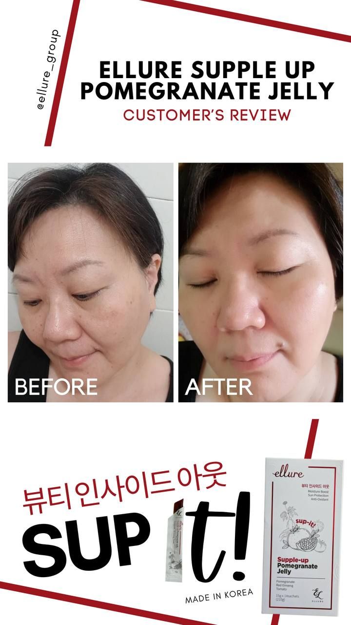 🇰🇷𝐌𝐀𝐃𝐄 𝐈𝐍 𝐊𝐎𝐑𝐄𝐀!🇰🇷 𝐄𝐋𝐋𝐔𝐑𝐄 𝟭𝟬-𝗜𝗡-𝟭 𝗥𝗘𝗗 𝗚𝗜𝗡𝗦𝗘𝗡𝗚 𝗦𝗞𝗜𝗡 𝗕𝗢𝗢𝗦𝗧𝗘𝗥 𝗝𝗘𝗟𝗟𝗬 | 𝐒𝐔𝐏-𝐈𝐓 𝐅𝐑𝐎𝐌 𝐊𝐎𝐑𝐄𝐀! SKIN SUPPLEMENT_30