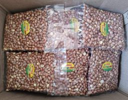 ဇလပ်နီ_လက်ဖက် အကြော်