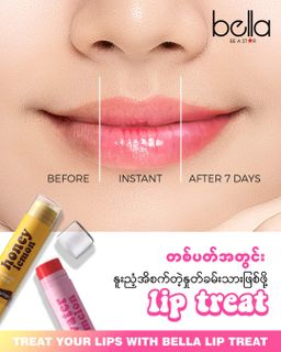 Bella_Lip Treat