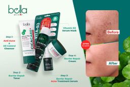Bella_CICA CARE+ Series