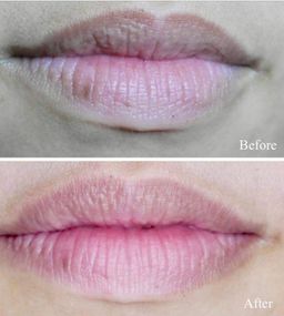 Dermalogica_Nightly Lip Treatment