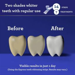 WHITENING STRIPS (7-DAY TREATMENT)