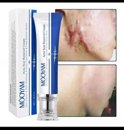 Scar Removal Cream