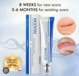 Scar Removal Cream