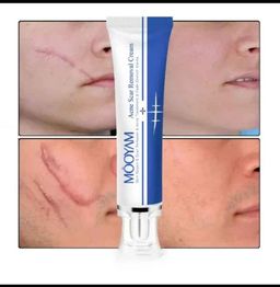 Scar Removal Cream