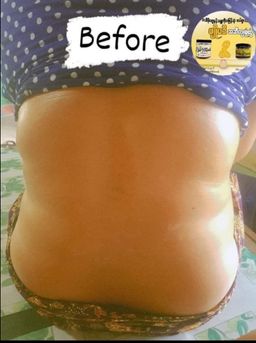 Pyo Madi_Body Sliming Set