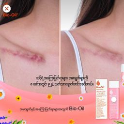 Bio‑Oil Myanmar_Skincare Oil