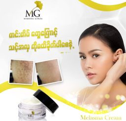Mimosa Ginza_Melasma Cream