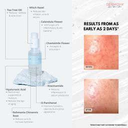 Dermova Hydrating Acne Serum
