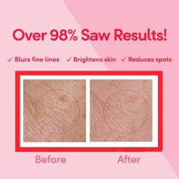 Ponds Age Miracle Wrinkle Corrector Night Cream, 50 g