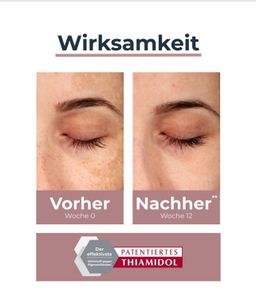 EUCERIN ANTI PIGMENT SERUM