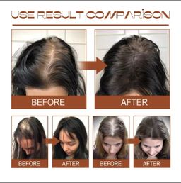 Batana Oil Hair Mask 