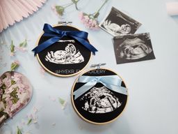 Classic Ultrasound Embroidery Hoop