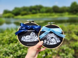 Classic Ultrasound Embroidery Hoop