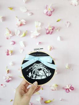 Classic Ultrasound Embroidery Hoop