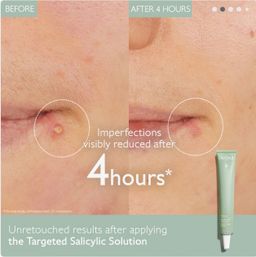 CADALIE Vinopure Color Correcting Spot Solution with Salicylic Acid