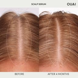 OUAI Hydrating Scalp Serum for Healthy, Fuller Looking Hair