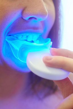 𝐊𝐢𝐭 𝐝𝐞 𝐛𝐥𝐚𝐧𝐜𝐡𝐢𝐦𝐞𝐧𝐭 𝐝𝐞𝐧𝐭𝐚𝐢𝐫𝐞 𝐚𝐯𝐞𝐜 𝐥𝐮𝐦𝐢𝐞̀𝐫𝐞 𝐋𝐄𝐃