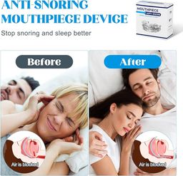 DAJILI Anti Snore Devices, Stop Snoring Devices, Anti-Snoring Anti-Molar Silicone Braces Dental Tray, Adjustable Anti-Snoring Mouth Guard for Better Sleep, Effective Snore Stopper for Men/Women