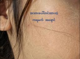 Shwe Sandalwood_ကရမက်