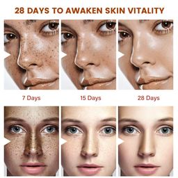 Bee Venom Melasma Relief Cream