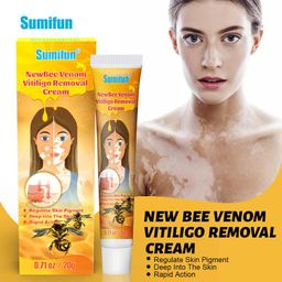 New Bee Venom Vitiligo Removal Cream