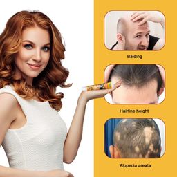 Bee Venom Alopecia Hair Growth Cream